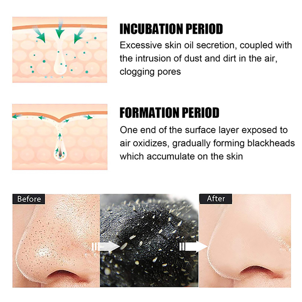 10/20/50/100PCS Nose Blackhead - Skincare Indonesia ulasan dan harga
