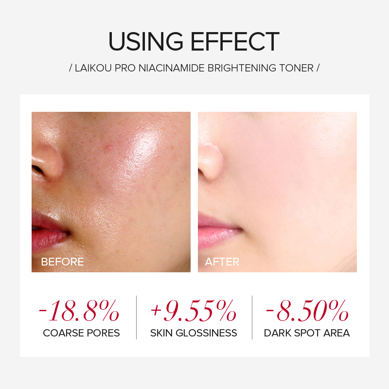 LAIKOU PRO Niacinamide 4Pcs Br - Niacinamide Brightening Serum ulasan dan harga