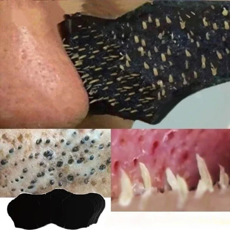 Unisex Blackhead Remove Mask N - Skincare Indonesia ulasan dan harga